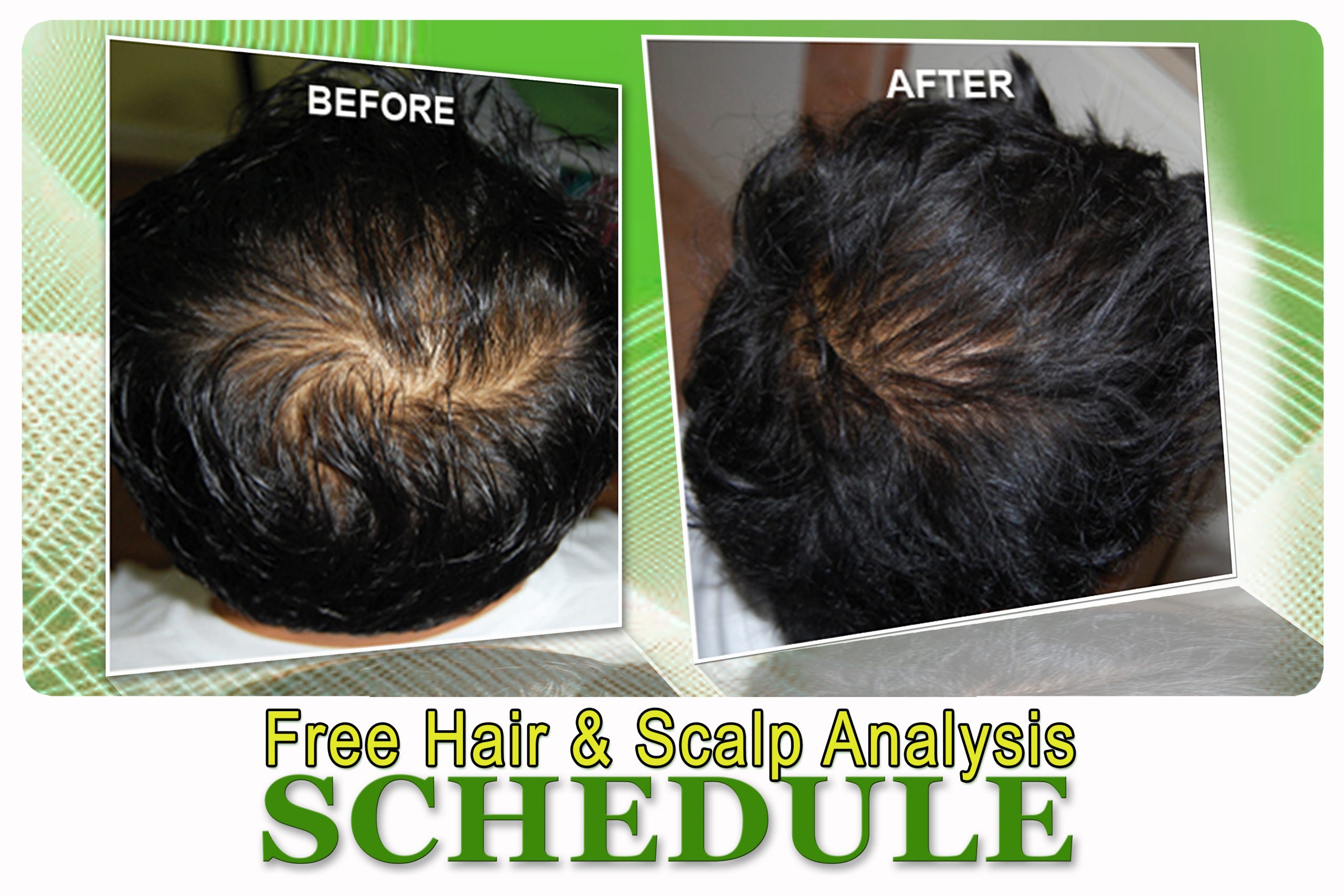 may-2012-free-hair-scalp-analysis-on-selected-drugstores-novuhair